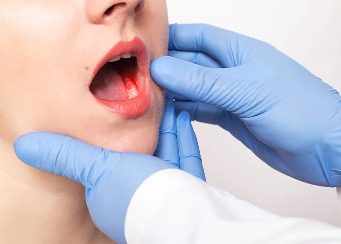 Periodontologinis gydymas