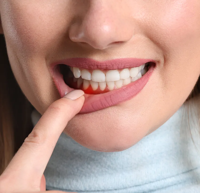 Periodontologinis gydymas