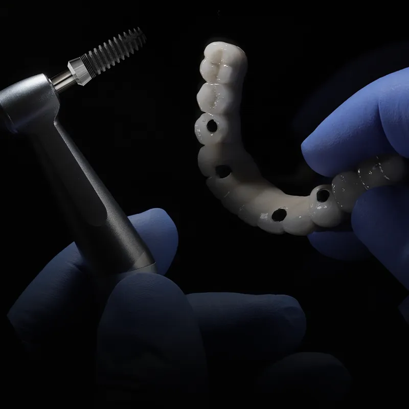 ATMINTINĖ APIE DANTŲ IMPLANTŲ PRIEŽIŪRĄ