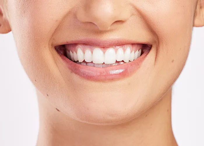 Dantų atkūrimas cirkonio implantais